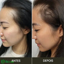 Escova de Terapia Capilar: TheraBrush Smarts 4 em 1 Escova Laser Antiqueda TheraBrush | 1 Unidade Escova Laser