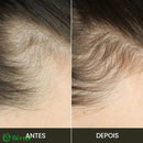 Escova de Terapia Capilar: TheraBrush Smarts 4 em 1 Escova Laser Antiqueda TheraBrush | 1 Unidade Escova Laser